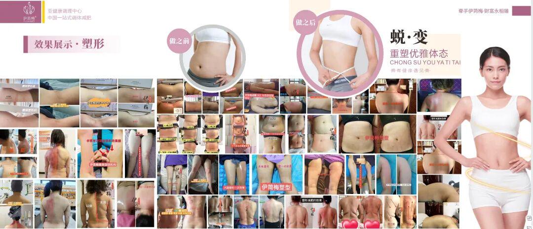 肥胖率十年翻倍，行业乱象待解——“伊简梅样本”如何为千亿瘦身市场立规矩？